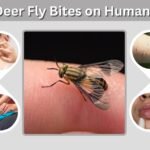 Deer Fly Bites on Humans: Signs, Symptoms and Treatment