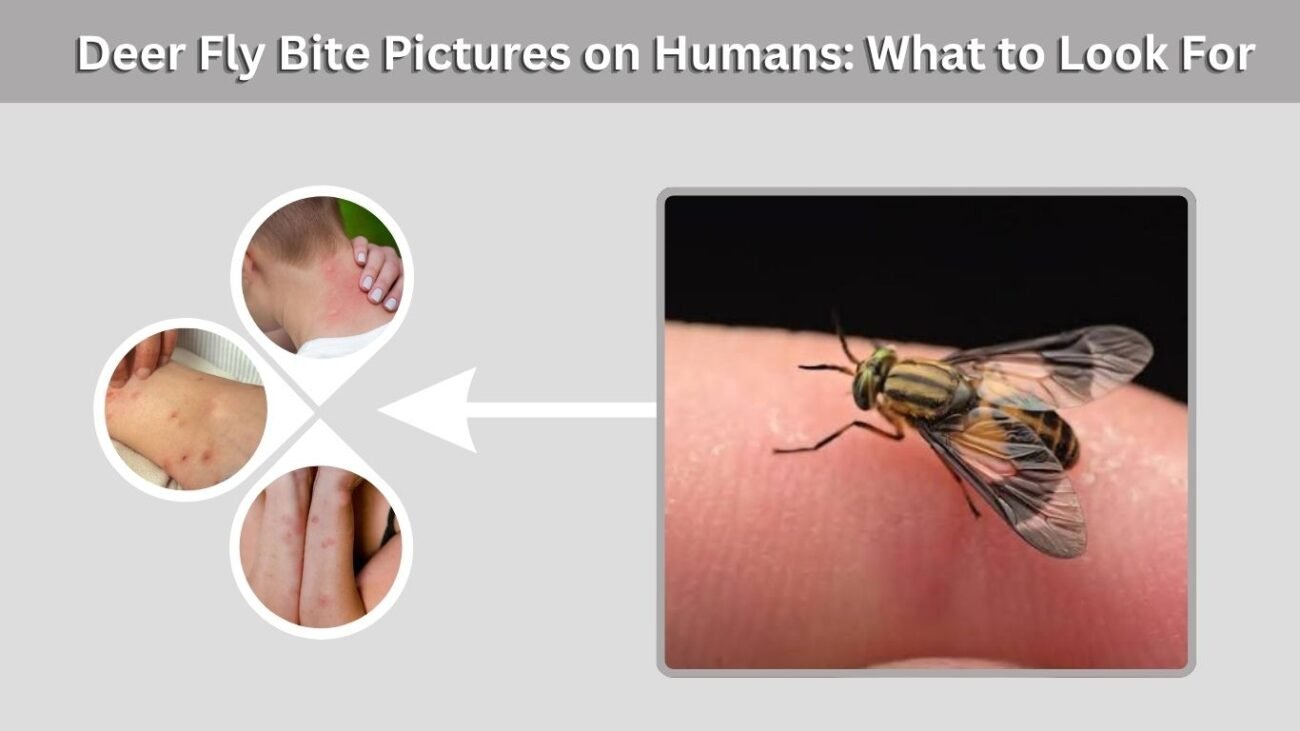 Deer Fly Bite Pictures on Humans: What to Look For
