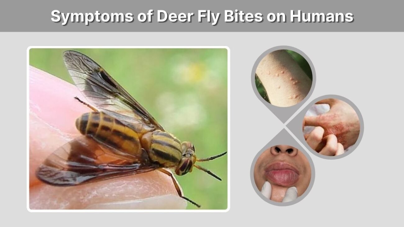 Symptoms of Deer Fly Bites on Humans