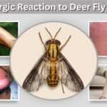 Allergic Reaction to Deer Fly Bite: Symptoms and Treatment