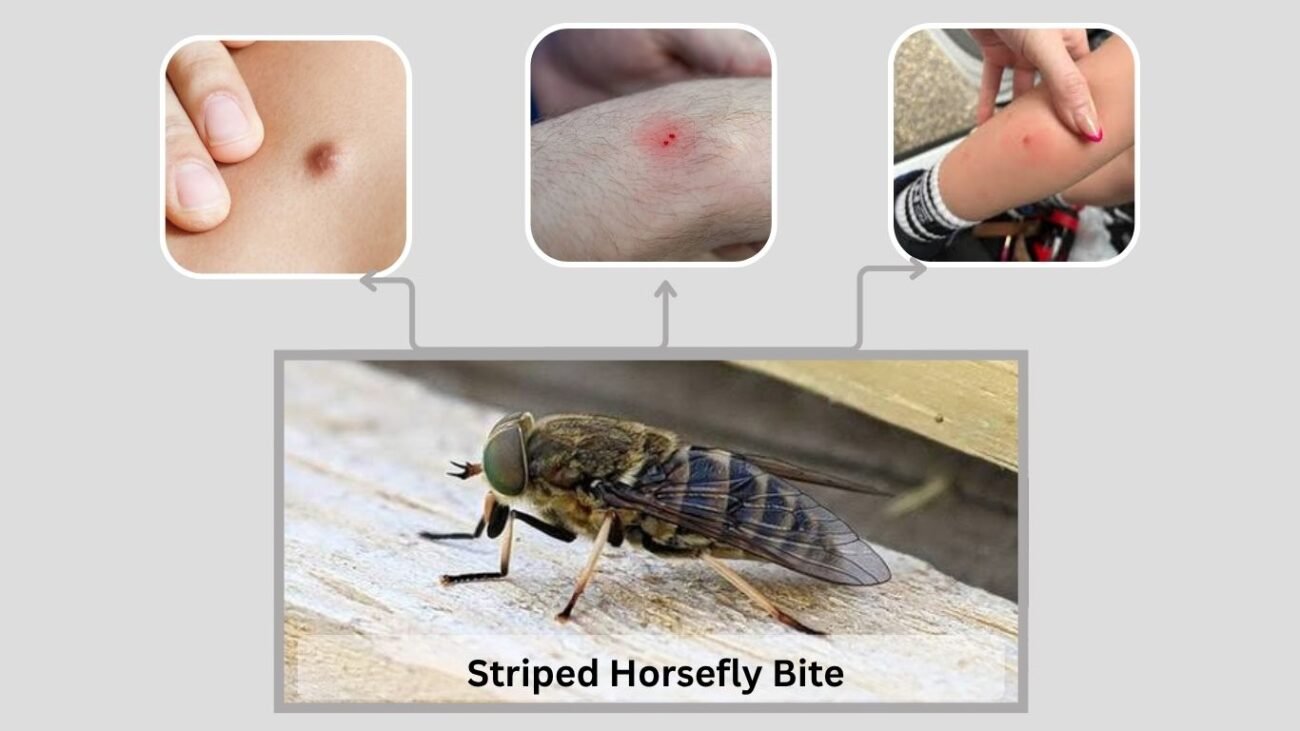 Striped Horsefly Bite