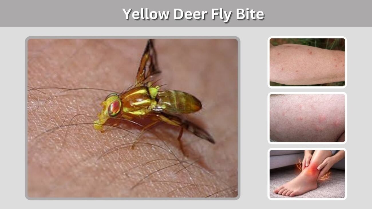 Yellow Deer Fly Bite